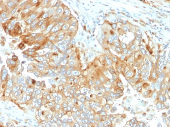 IHC staining of FFPE human endometrium with HLA-DRB1 antibody (clone DA2). HIER: boil tissue section