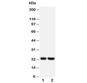 Western blot testing of FGF9 antibody and Lane 1: rat brain; 2: human HeLa lysate; Predicted molecul
