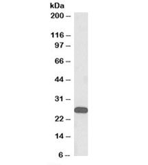 Western blot testing of human olfactory bulb lysate with HOXC6 antibody at 0.3ug/ml. Predicted molec