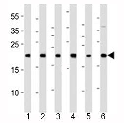 Western blot analysis of lysate from 1) HeLa, 2) 293, 3) HT-1080, 4) Raji, 5) SH-SY5Y and 6) THP-1 c