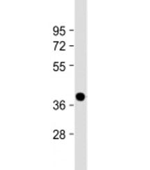 Western blot testing of human heart lysate with NMNAT1 antibody at 1:2000. Predicted molecular weigh