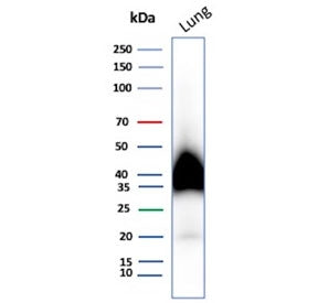 Western blot testing of human lung tissue lysate with Gp36 antibody. Predicted molecular weight ~25 