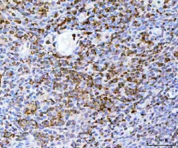 TRAIL R2 Antibody / DR5