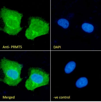 PRMT5 Antibody