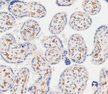 IHC testing of FFPE human placental tissue with EHD2 antibody. HIER: steam section in pH9 EDTA for 2