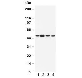 Dopamine Receptor D3 Antibody