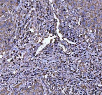 NLRP3 Antibody (NALP3)
