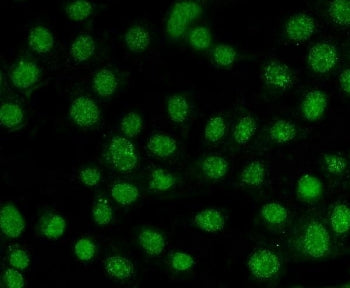 AKT1/2/3 Antibody