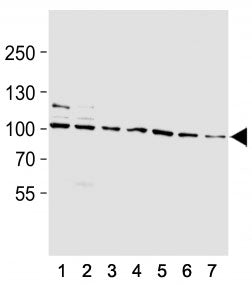 HSP90 Antibody