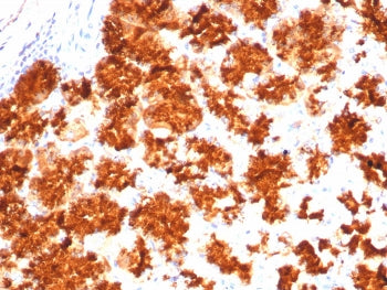 IHC staining of FFPE human stomach tissue with Interleukin-2 antibody (clone IL2/4983). HIER: boil t