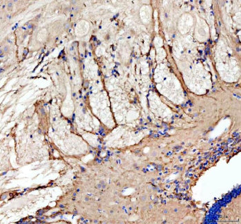 Immunohistochemical analysis of Grin1a/b protein using Zebrafish Grin1 antibody and paraffin-embedde