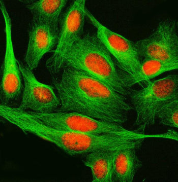 Immunofluorescent staining of FFPE human U-2 OS cells with SPRED2 antibody (red) and Alpha Tubulin m