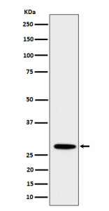 Western blot analysis of PSMB10 expression in human Daudi cell lysate using PSMB10 antibody. Predict