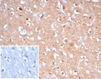 Beta Tubulin Antibody / TUBB3
