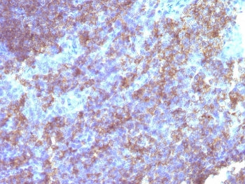 IHC staining of FFPE human tonsil tissue with CD45 antibody. HIER: boil tissue sections in pH 9 10mM