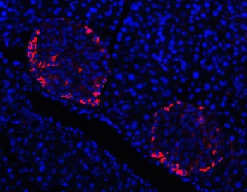 TTR Antibody / Transthyretin / Prealbumin