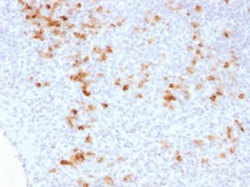 IHC testing of FFPE human tonsil stained with Kappa Light Chain antibody (clone KLC1278). Required H