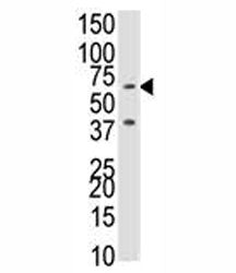 Western blot analysis of BMPR1B antibody and NCI-H460 cell lysate. Predicted molecular weight 55~60 