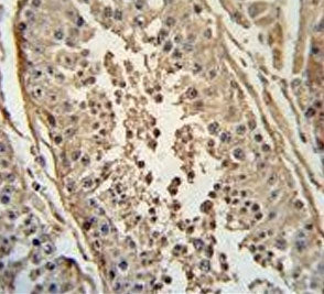 IHC testing of FFPE human testis tissue with FBX24 antibody. HIER: steam section in pH6 citrate buff