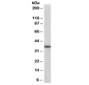Western blot testing of A431 lysate with PDLIM4 antibody at 0.2ug/ml. Predicted molecular weight: ~3