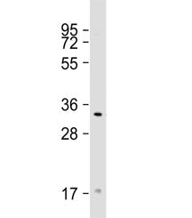 Western blot testing of human ZR-75-1 cell lysate with TAS2R50 antibody at 1:1000. Predicted molecul