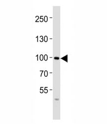 FGFR4 Antibody