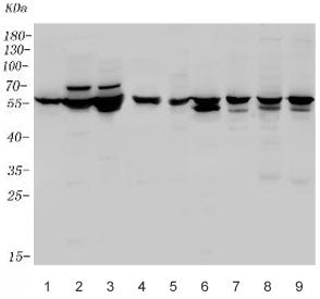 Western blot testing of human 1) U-87 MG, 2) SH-SY5Y, 3) SW620, 4) Raji, 5) rat brain, 6) rat heart,