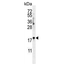 Western blot testing of human NCI-H460 cell lysate with FAM218A antibody. Predicted molecular weight