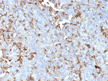 IHC staining of FFPE human adrenal gland tissue with Periostin antibody (clone POSTN/4095). HIER: bo