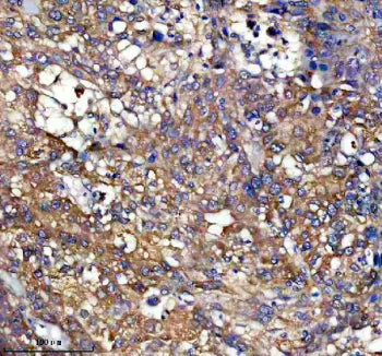 Immunohistochemical staining of PEX11B using anti-PEX11B antibody. PEX11B was detected in a paraffin