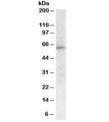 Western blot testing of peripheral blood mononucleocyte lysate with G6PD antibody at 1ug/ml. Predict