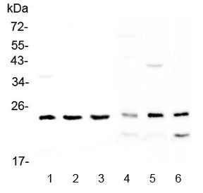 Western blot testing of 1) human MDA-MB-453, 2) human SK-OV-3, 3) human A431, 4) rat testis, 5) mous