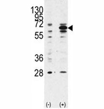 Western blot analysis of Beclin 1 antibody and 293 lysate transiently transfected with the BECN1 gen