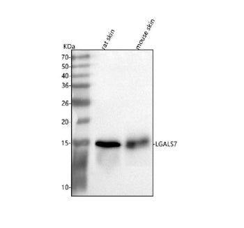 Western blot analysis of Galectin-7/LGALS7 using anti-LGALS7/7B antibody. Lane 1: rat skin tissue ly
