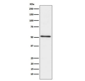 Western blot testing of human prostate cancer lysate with ACPP antibody. Expected molecular weight: 