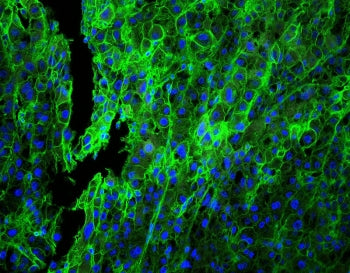 HLA-C Antibody