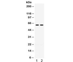 TCP1 gamma Antibody / CCT3