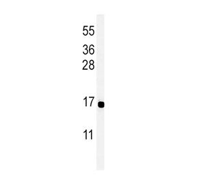 Western blot testing of human MCF7 cell lysate with Peptide YY antibody. Expected molecular weight: 