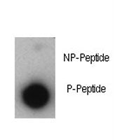Phosphorylated-p21 Antibody (pT57)