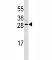 EPO antibody western blot analysis in CEM lysate. Predicted molecular weight: 18-34 kDa depending on