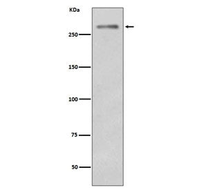 Western blot testing of mouse skeletal muscle with Dysferlin antibody. Predicted molecular weight ~2