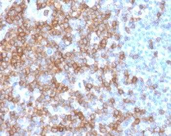 IHC staining of FFPE human spleen with CD43 antibody (clone CDLA43-2). HIER: boil tissue sections in