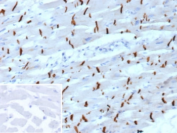 IHC staining of FFPE human heart tissue with Cadherin 2 antibody (clone CDH2/9488). Inset: PBS used 