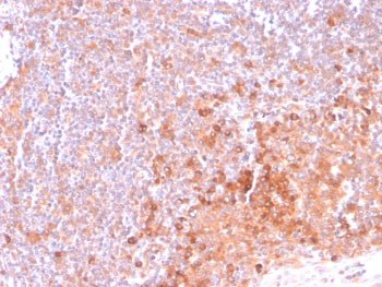 IHC staining of FFPE human tonsil tissue with OX40 antibody (clone OX40/3108). HIER: boil tissue sec