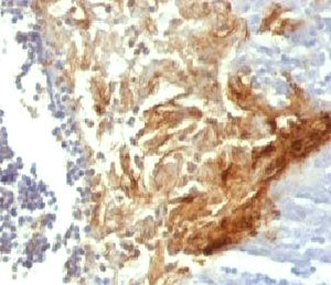 IHC testing of FFPE human tonsil with Involucrin antibody (clone INVO49). Staining of formalin-fixed