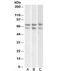 Western blot testing of A) HeLa, B) HepG2, and C) K562 nuclear lysates with GNL3 antibody at 2ug/ml.