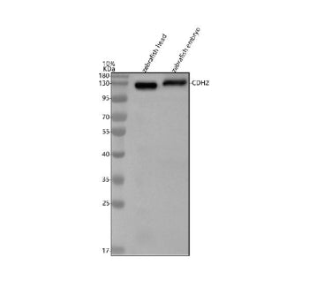Western blot analysis of N-cadherin protein using Zebrafish N-cadherin antibody and 1) zebrafish hea