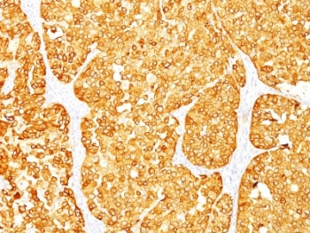MART-1 / Melan-A Antibody Cocktail