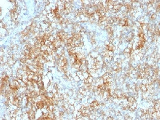 CD147 / Emmprin / Basigin Antibody