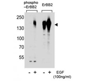 Western blot analysis of extracts from A431 cells, untreated or treated with EGF, using phospho-HER2